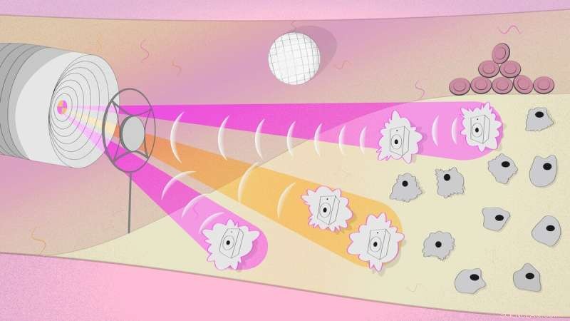 New Optoacoustic Endoscopic Probe Brings Breakthrough to Microsurgery