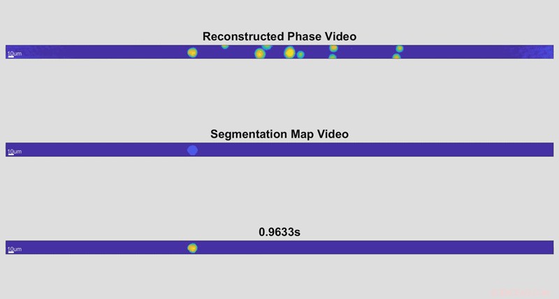 Ultra-Fast Holographic Imaging Detects Cellular Disease Markers