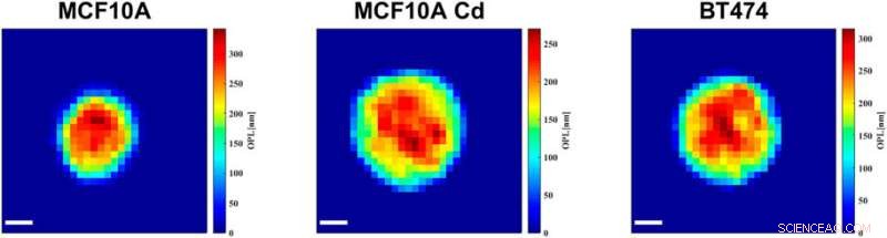 Ultra-Fast Holographic Imaging Detects Cellular Disease Markers