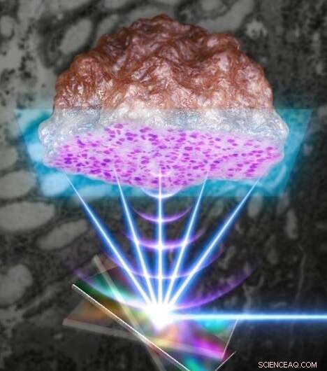 Intraoperative Label‑Free Histopathology Using MEMS Scanners for Rapid Cancer Diagnosis