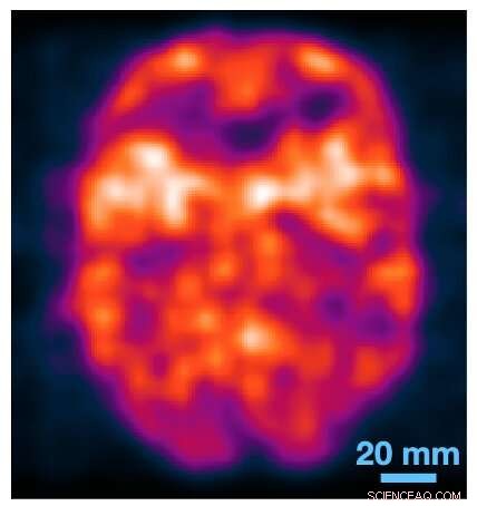 Revolutionary Photon Detectors Promise Affordable, Simplified Medical Imaging
