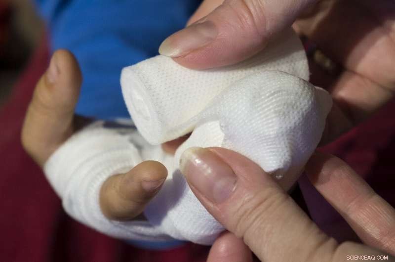 Innovative Smart Bandage Enables Non‑Invasive Monitoring of Chronic Wound Healing