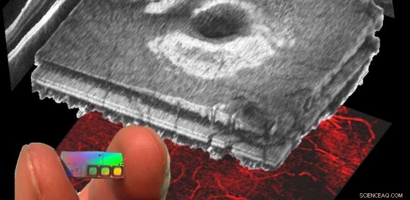 Bright Outlook: Advanced On-Chip OCT Scans for 30-Year-Olds