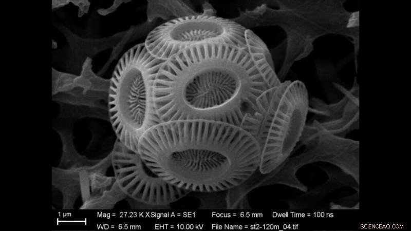 The Calcium Carbonate Cycle in the North Pacific: Key Insights and Implications