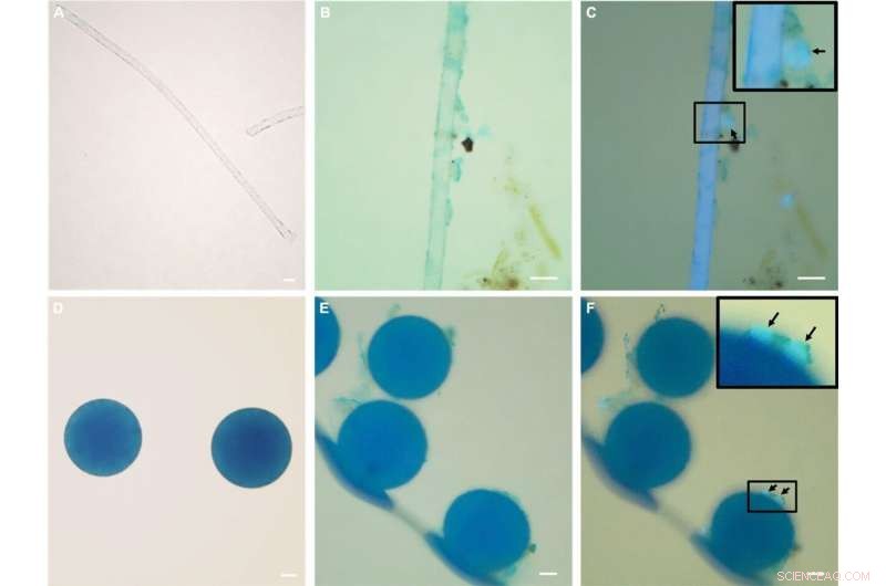 Parasites May Use Microplastics to Spread in Oceans, Raising Public Health Concerns