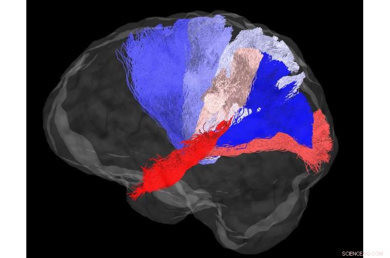 GPU-Powered Machine Learning Algorithm Enhances Human Brain Connectivity Mapping