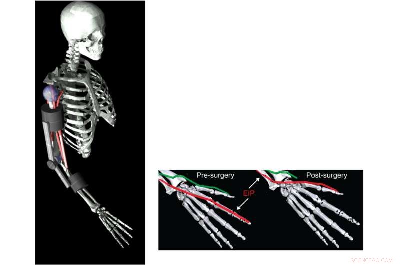 MyoSuite: Open-Source AI Framework for Realistic Digital Human Movement