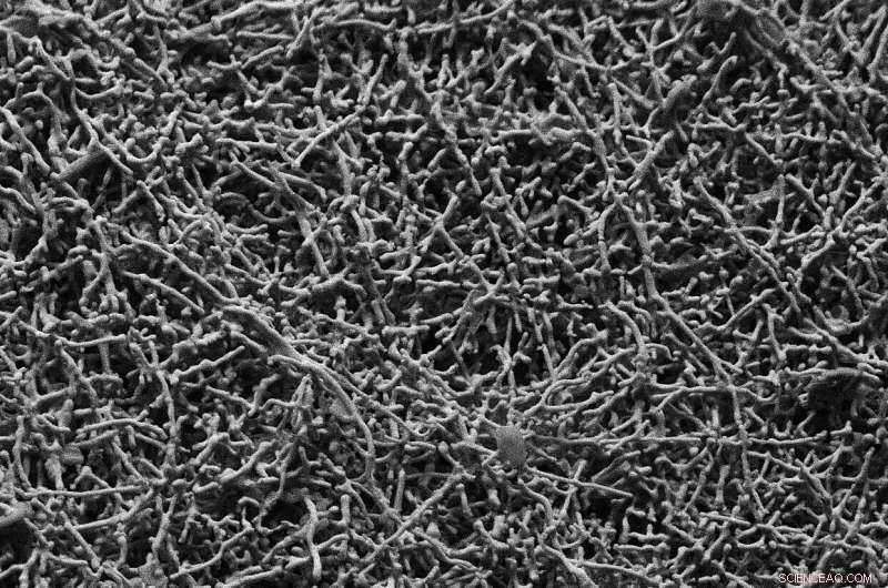 Advanced Battery Materials for Electric Vehicles: A Breakthrough in Energy Storage