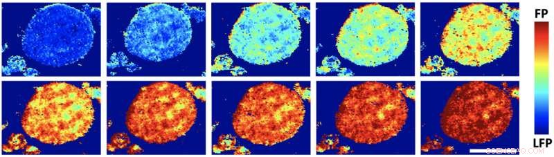 Research Reveals Stress from Misaligned Particles Limits Lithium Ion Flow in LFP Battery Cathodes