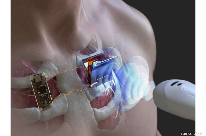 Ultrasonic Wireless Charging: Safe Power for Implanted Medical Devices and Underwater Electronics