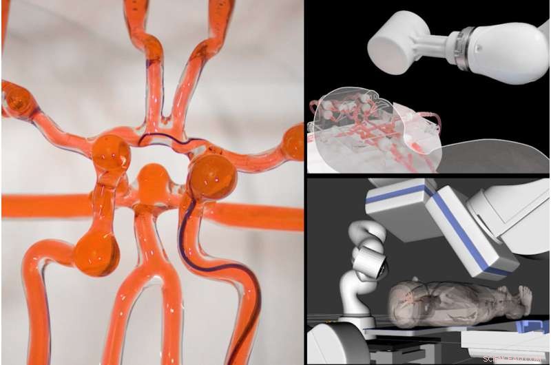 Remote Surgery Breakthrough: Joystick-Controlled Robot Assists in Stroke Treatment