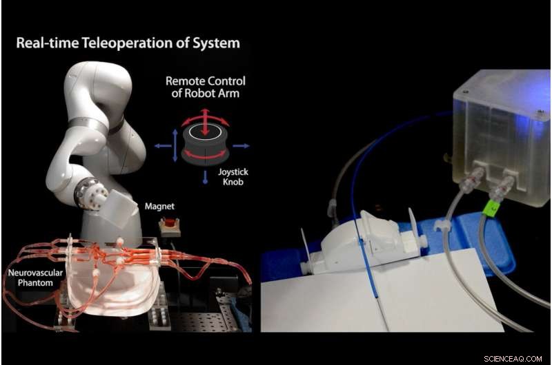 Remote Surgery Breakthrough: Joystick-Controlled Robot Assists in Stroke Treatment