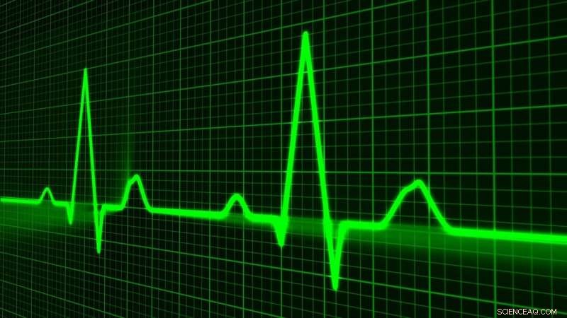 Heartbeat Biometrics: Novel Algorithm Achieves Unique Human Identification