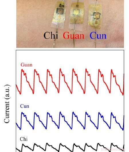 Innovative Double Helix Yarn Piezoresistive Sensor for Accurate Pulse Monitoring