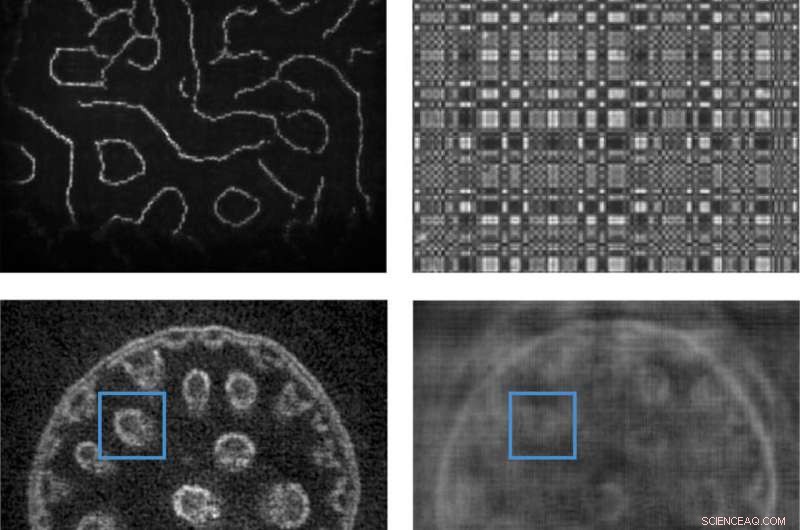 Bio-FlatScope: Innovative Lensless Camera for Precision Biological Monitoring