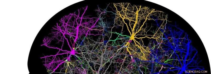 Machine Learning Decodes Neuron Complexity: UW-Madison Research Insights