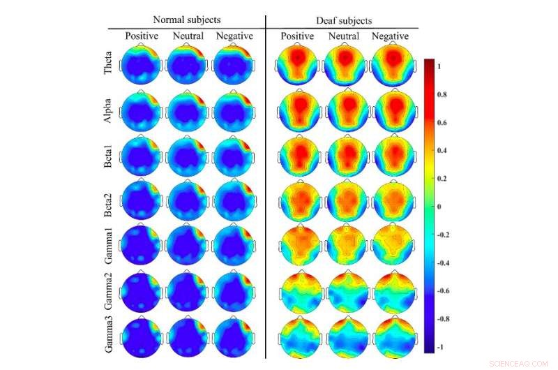Novel EEG Brain Network Framework for Accurate Emotion Recognition in Deaf Individuals