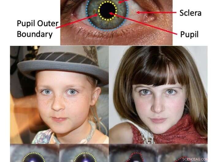 Detecting GAN-Generated Faces: How Pupil Shape Irregularities Reveal Synthetic Images