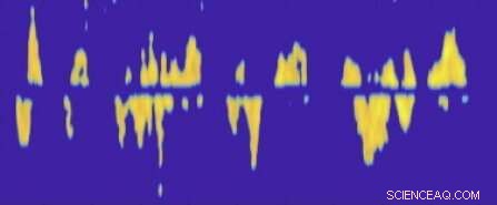 Noise-Canceling Headphones Translate Sign Language Using Doppler Technology