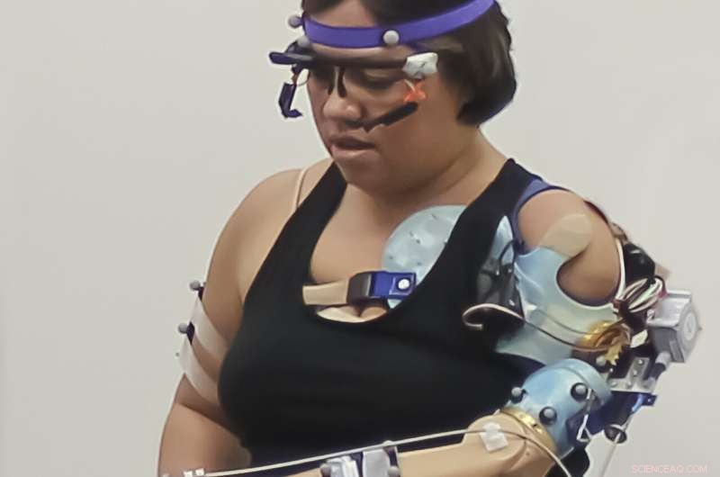 Cleveland Clinic s Bionic Arm Restores Natural Behaviors for Upper Limb Amputees