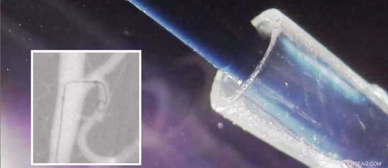 Revolutionary Steerable Catheter Enhances Precision in Brain Surgery