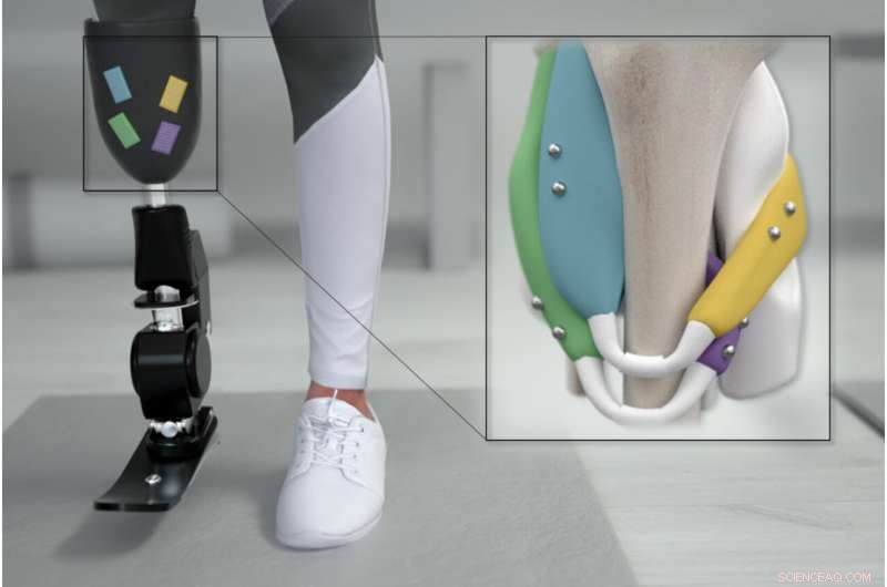 MIT Media Lab s Magnet-Based Innovation Transforms Prosthetic Limb Control