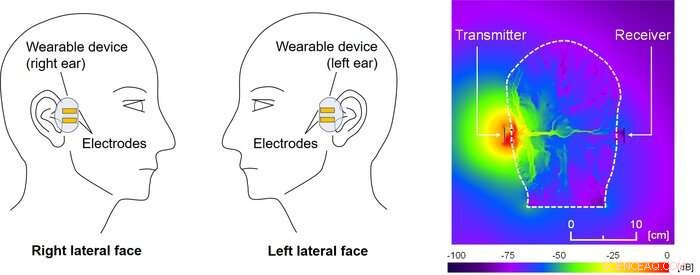 Human Body Communication in Binaural Hearing Aids: Advancing Signal Transmission Through the Head