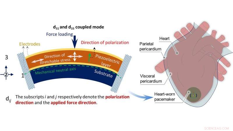 Revolutionary Battery-Free Pacemaker Powered by Heart s Energy