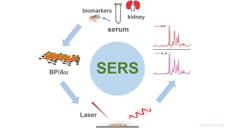 Revolutionary SERS Technique Enhances Donor Kidney Assessment to Expand Transplant Options