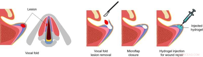 McGill Scientists Develop Tough Biomaterial to Repair Heart, Muscle, and Vocal Cords