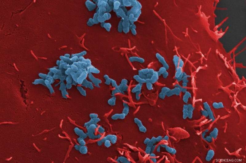 Antibodies Prevent Bartonella henselae Infection by Blocking Cell Adhesion