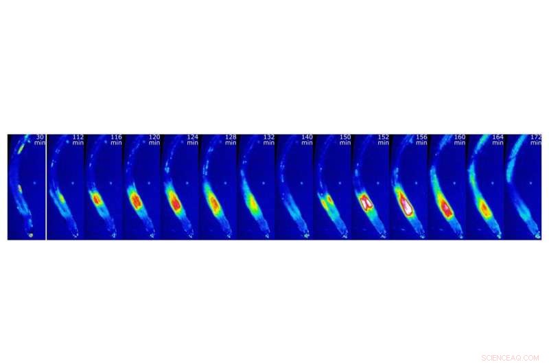Breakthrough Discovery: How Plant Roots Sense Soil Manganese Through Calcium Signals