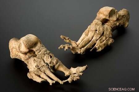 Ancient DNA Reveals Pathogen Evolution: Insights from Historical Outbreaks