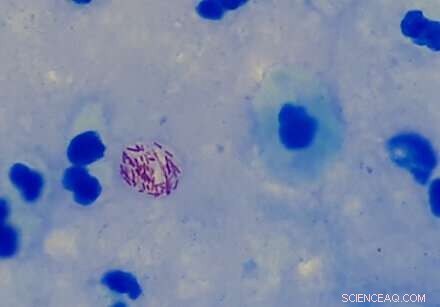 Ancient DNA Reveals Pathogen Evolution: Insights from Historical Outbreaks