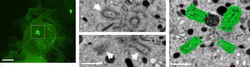 Researchers Uncover Mechanism That Boosts Immune Cell Speed and Mobility