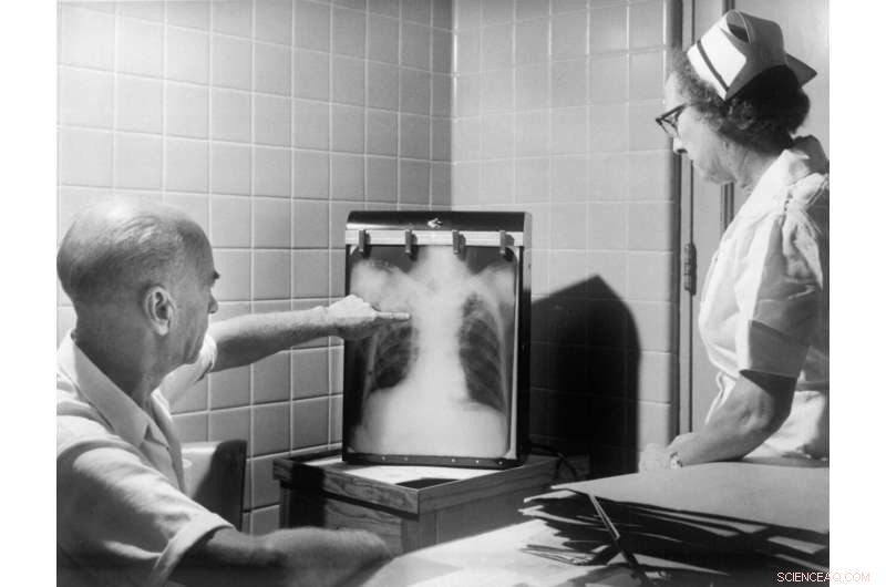 Tuberculosis Pathogen s Immune Evasion: New Protein Mechanism Discovered