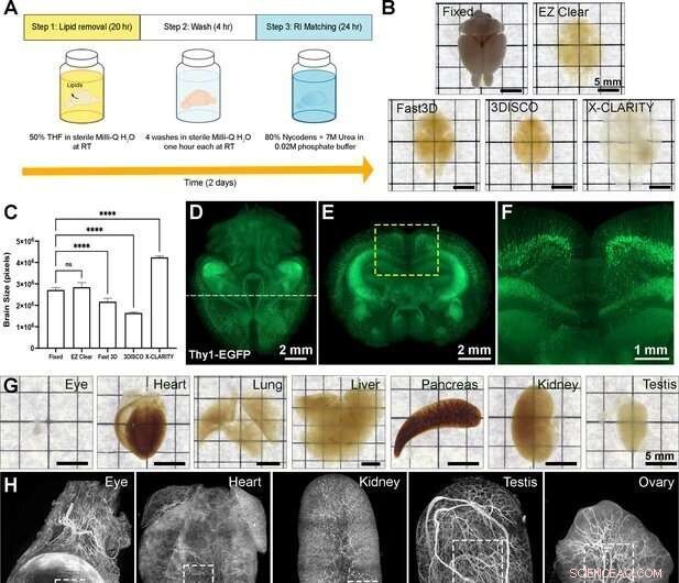 EZ Clear: Rapid and Robust Tissue Clearing for Transparent Whole Mouse Organ Imaging