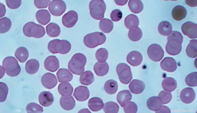 Aestivation in Malaria Mosquitoes: A Breakthrough for Disease Control