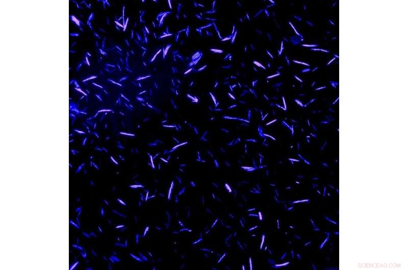 Study Reveals Gut Bacteria That Balance Dietary Cholesterol for Health