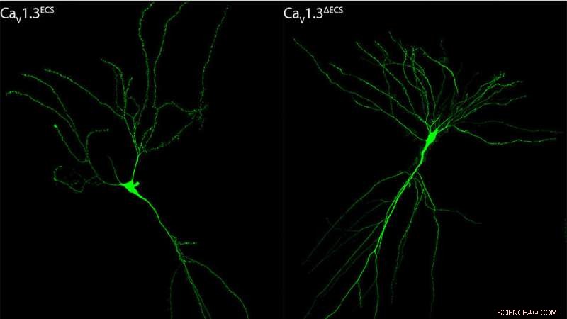 Loss of RNA Editing in Caᵥ1.3 Channel Boosts Spatial Memory but at a Cost