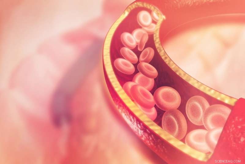 New Computational Model Reveals How Cell Communication and Mechanical Stress Drive Arterial Thickening