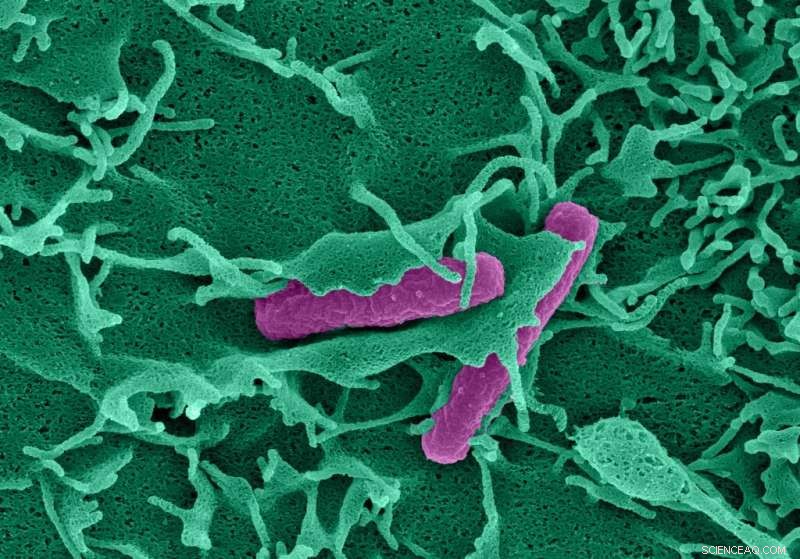 Physical Forces from Bacterial Infections Trigger Immune Response