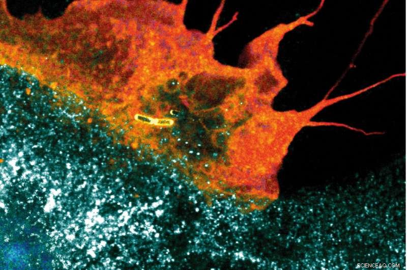 Physical Forces from Bacterial Infections Trigger Immune Response