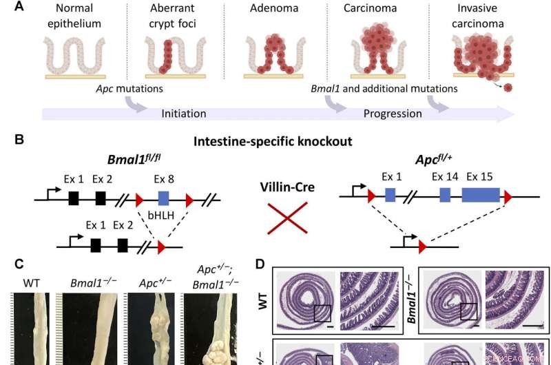 Circadian Clock Disruption Accelerates Colorectal Cancer Progression, Study Finds