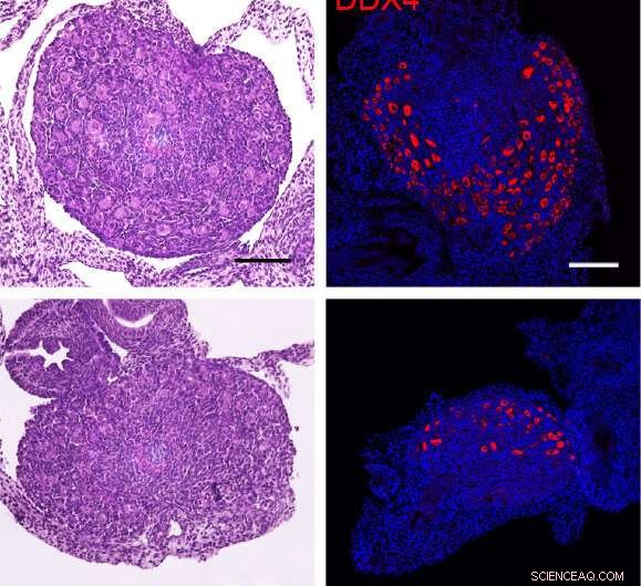 PRC1 Gene Complex Essential for Ovarian Reserve Formation, Study Reveals