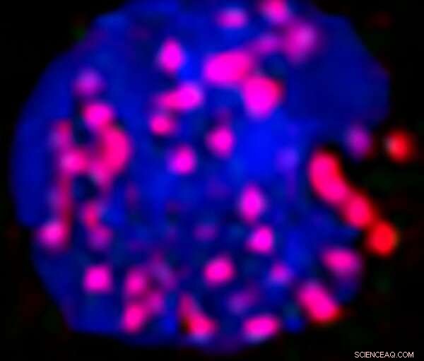 Replication Protein A and WASp: Essential Partners in DNA Damage Repair