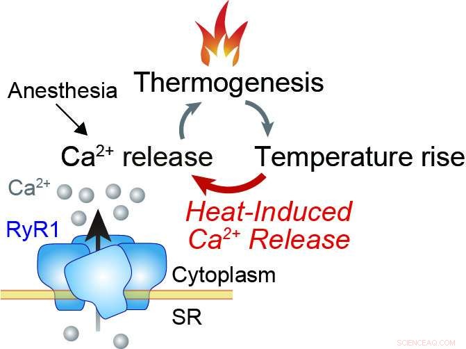 New Research Identifies Heat-Activated RyR1 Channels as Key Driver of Malignant Hyperthermia