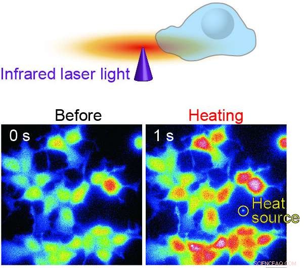 New Research Identifies Heat-Activated RyR1 Channels as Key Driver of Malignant Hyperthermia