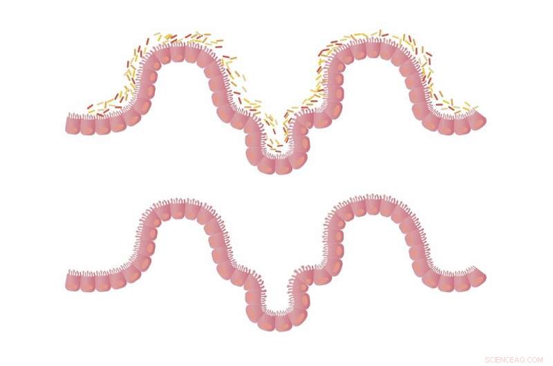 Newborn Antimicrobial Resistance: A Critical Challenge in Low- and Middle-Income Countries