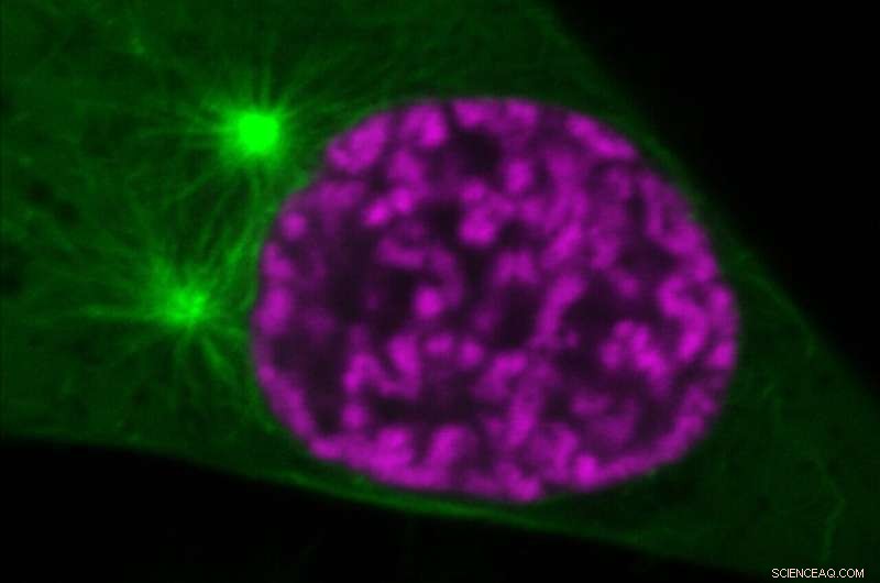 Efficient Genome Packaging: Ensuring Chromosome Integrity During Cell Division